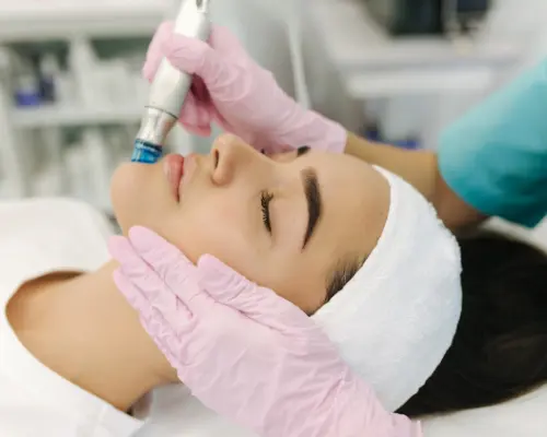 Laser facial treatments